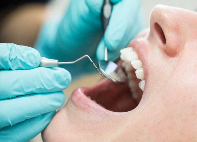 Tips to Help Ease Dental Anxiety – Cleveland Clinic